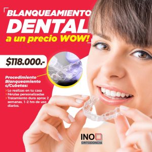 https://www.ino.cl/web/wp-content/uploads/2023/09/promo-blanqueamiento-2025-web-300x300.jpg