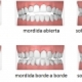 Maloclusión Dental - Instituto Nacional de Ortodoncia